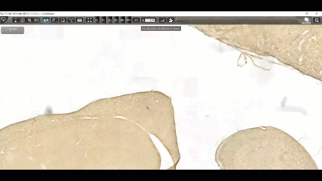 cell counting shorter